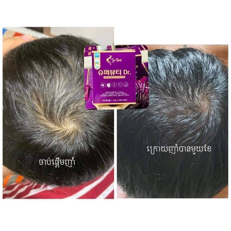 SUPER BEAUTY DOCTOR កូឡាជែនអកញាំមាន100កញ្ចប់